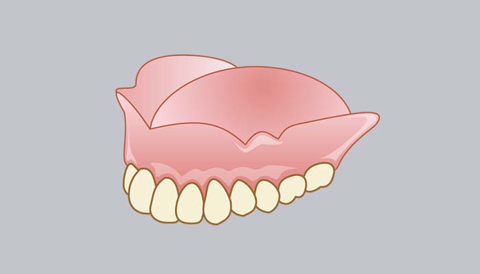 総入れ歯